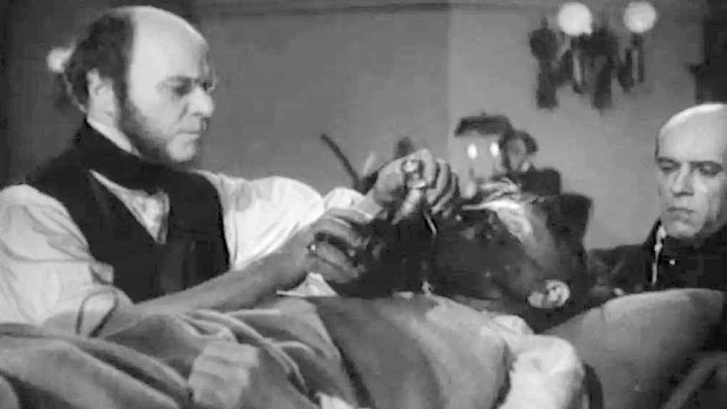 Н.И. Пирогов применяет эфирный наркоз.