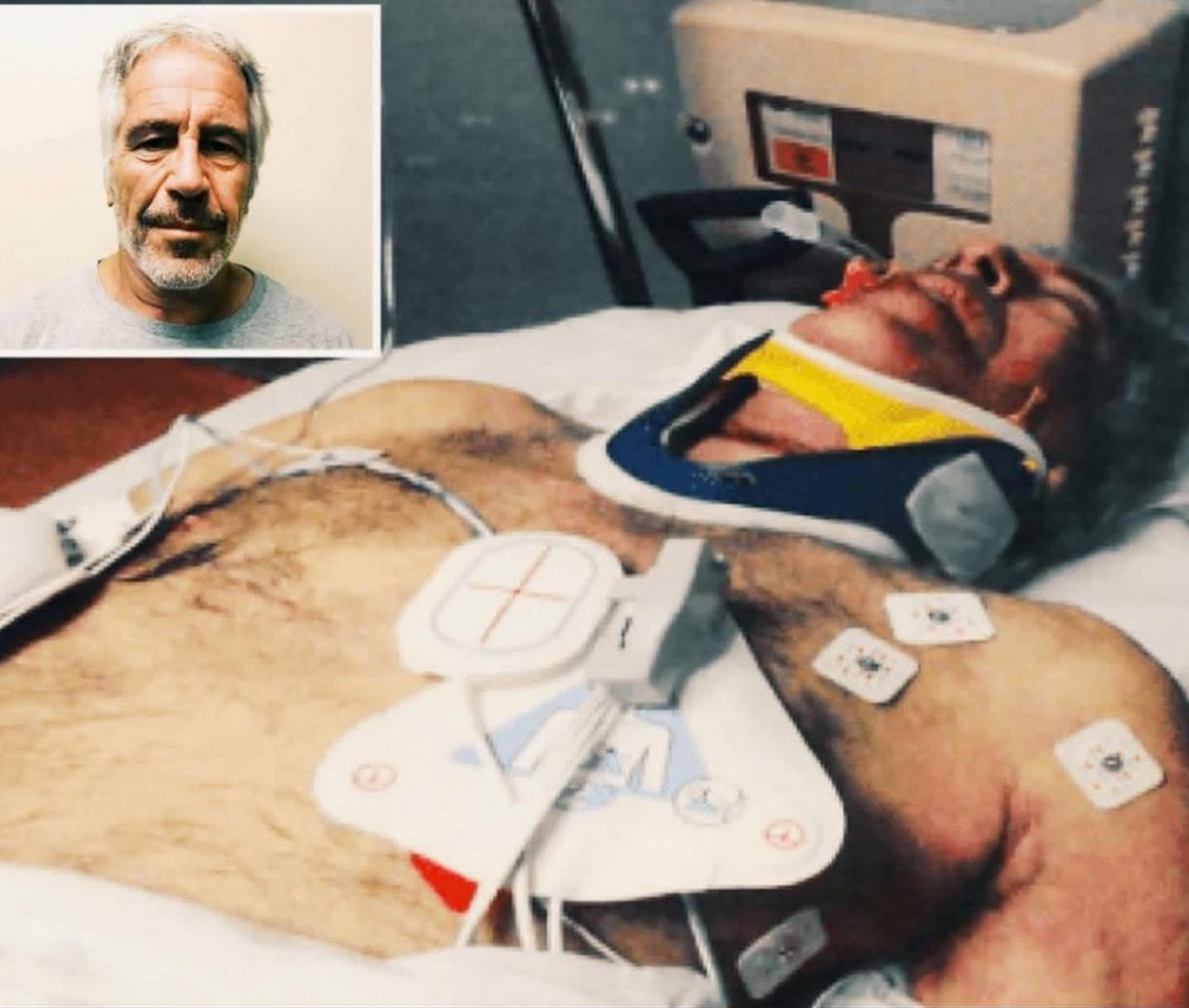 Снимок тела Эпштейна после попыток его реанимации.